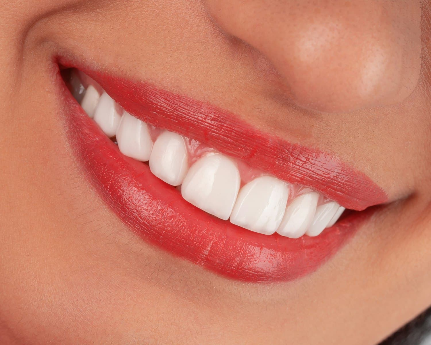 Happy patient smiling